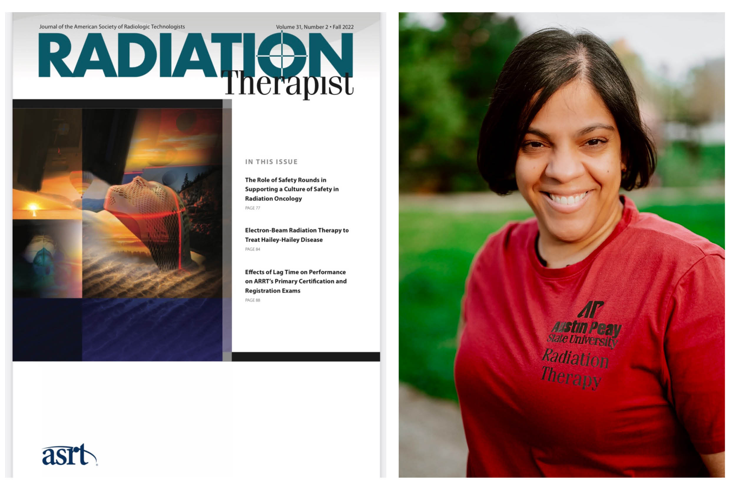 Austin Peay radiation therapy graduate publishes case study in national journal