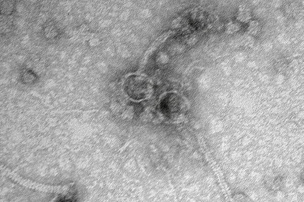 As part of their research, the students named their newly discovered phages and entered them into a global database. We thought it might be neat to ask the students how they picked their phage names. Meet Austin Peay’s phages: Scumberland, Danno and Otwor.